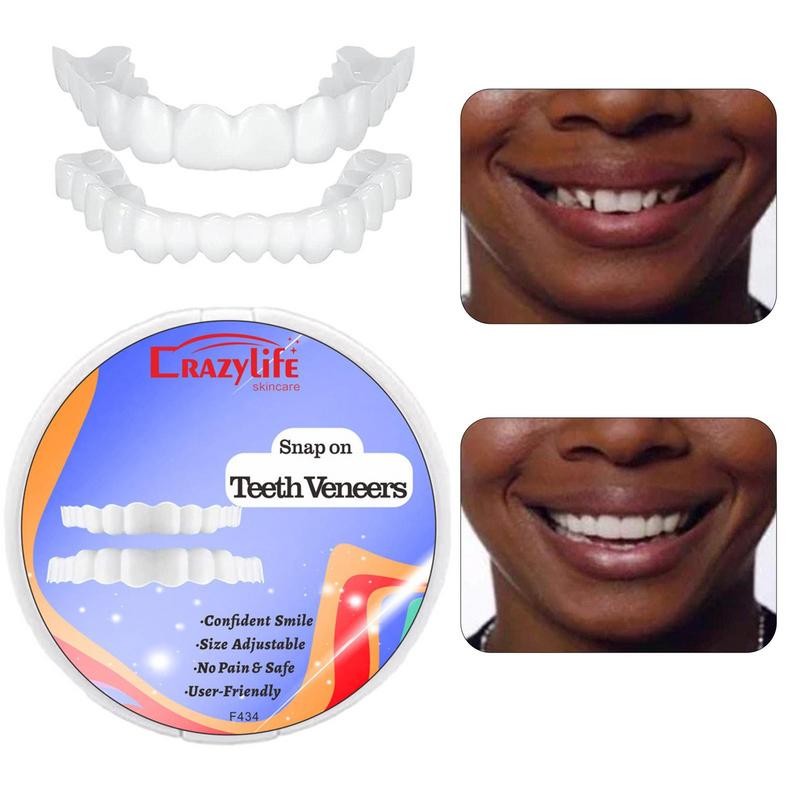 Jual Snap On Teeth Veneers Cover The Imperfects Teeth Fake Tooth ...