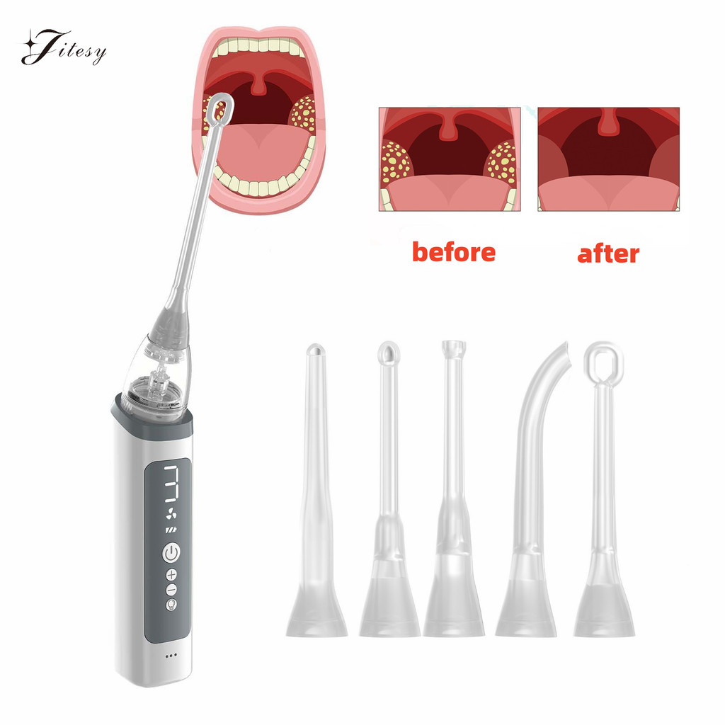 Jual Vacuum Tonsil Stone Remover Tool Built-In LED light 8 Suction ...