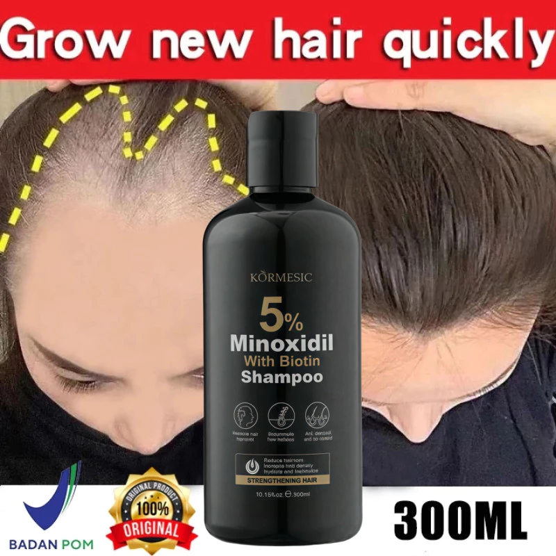 Kormesic Shampo Penumbuh Rambut: Review Shampo Minoxidil dengan Biotin & Minyak Jarak