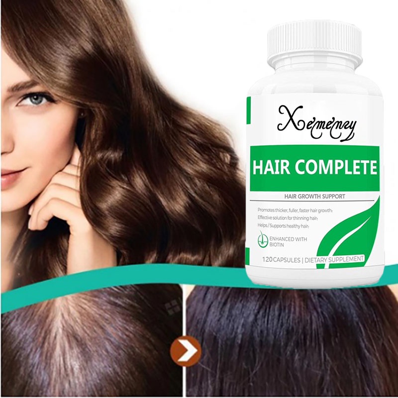 Jual Kapsul penumbuh rambut asli untuk mengatasi kebotakan dan rambut ...
