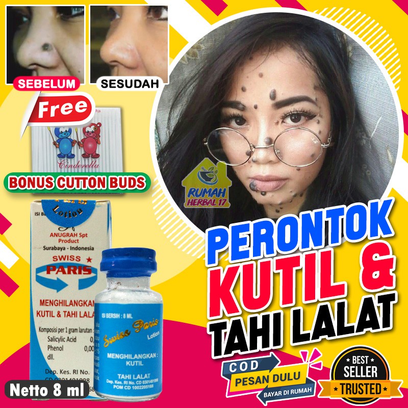 Jual Swiss Paris Lotion Original Obat Penghilang Tahi Lalat Dan Kutil