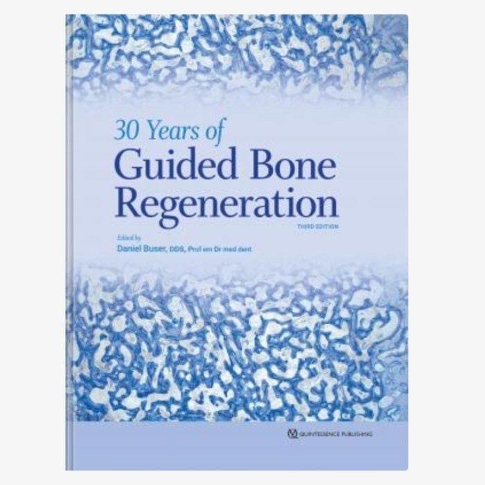 Jual Buku 30 Years of Guided Bone Regeneration in Implant Dentistry ...