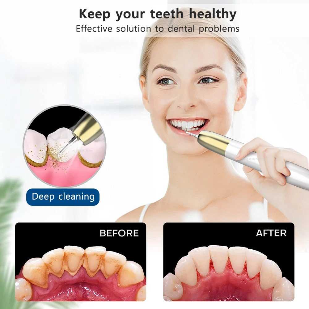 Jual Pembersih Karang Gigi Elektrik Ultrasonic Tooth Cleaner 500 mAh