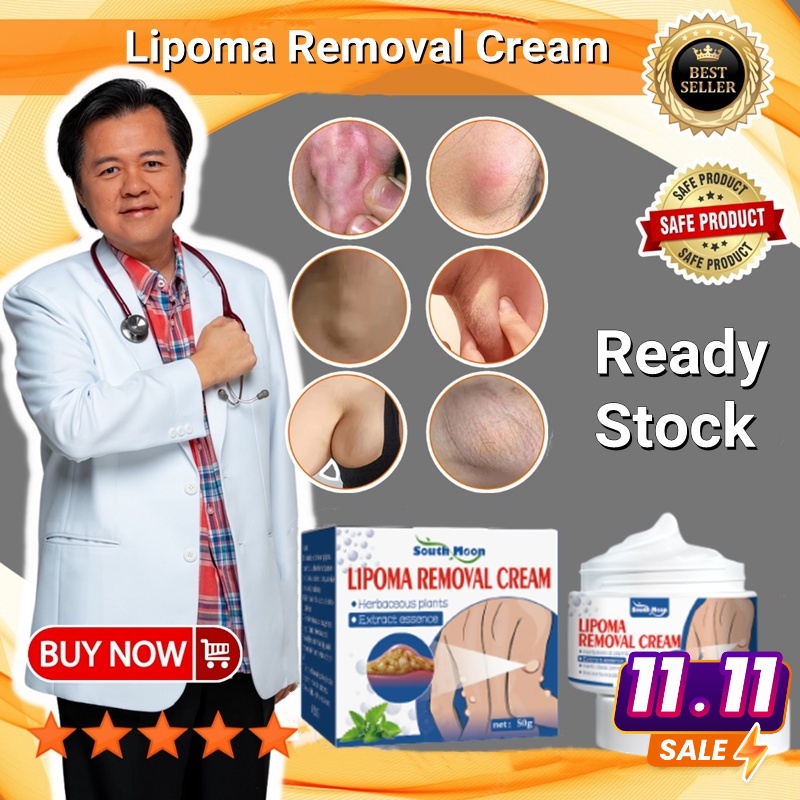 Jual Obat Benjolan Lipoma Cream 50gr Lipoma Benjolan Di Leher /Benjolan ...