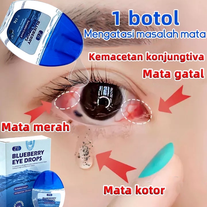 Jual OBAT MATA MINUS /TETES MATA MINUS/ KATARAK/ SILINDER/OBAT MATA ...