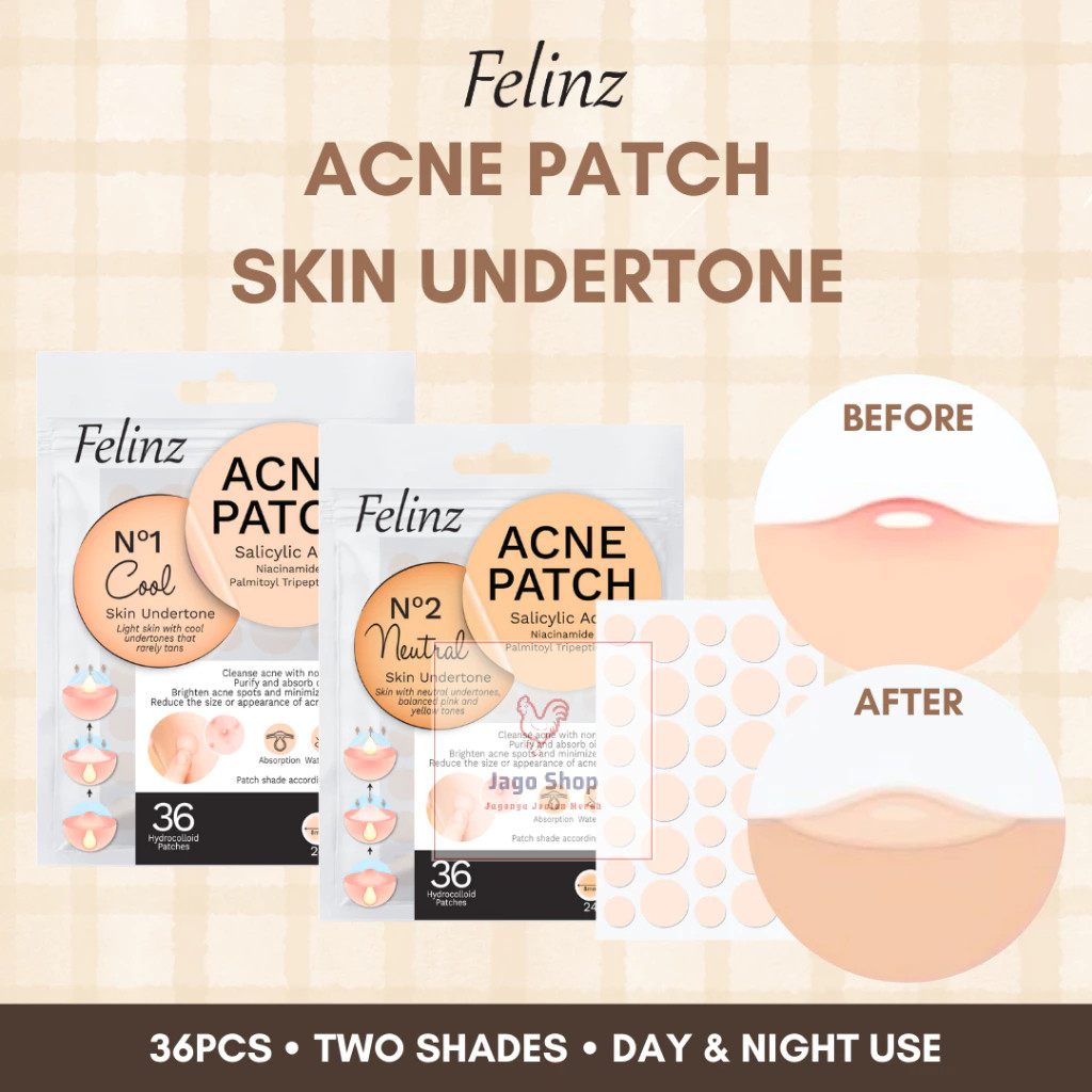 Jual FELINZ ACNE PATCH SALICYLIC ACID - 36 PATCHES COOL & NEUTRAL ...