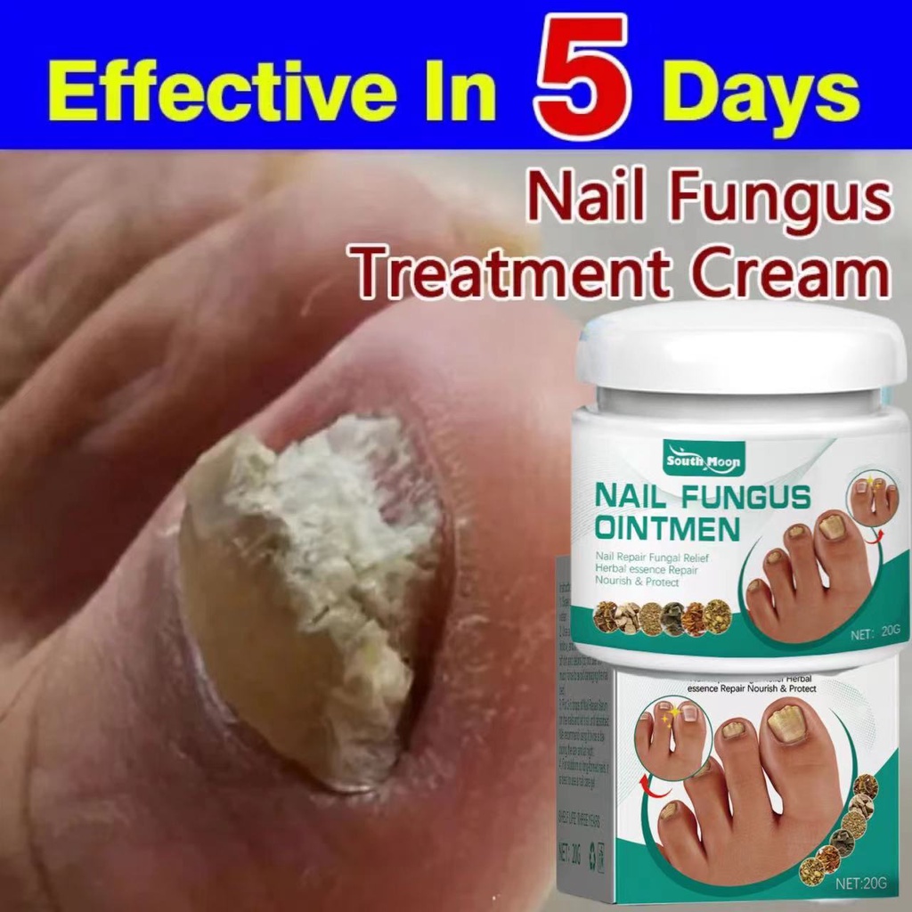 Jual Nail Repair Cream Nail Foot Whitening Toe Nail Fungus Removal Gel