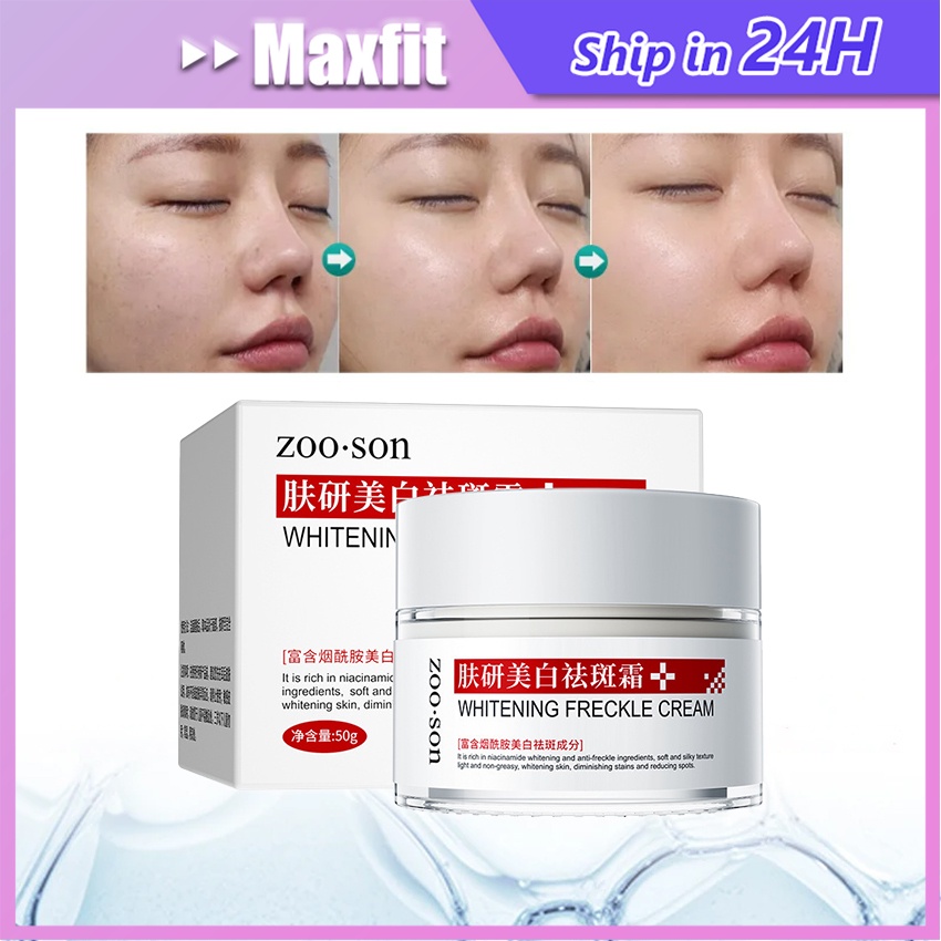 Jual Whitening Freckle Cream Remove Dark Spots Anti Freckle Penuaan Asam Hyaluronic Whitening