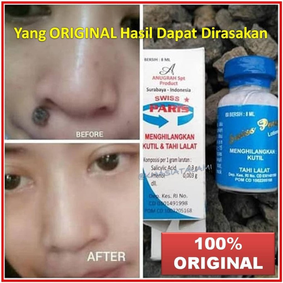 Jual Penghilang Tahi Lalat Dan Kutil Swiss paris Swis Paris Original