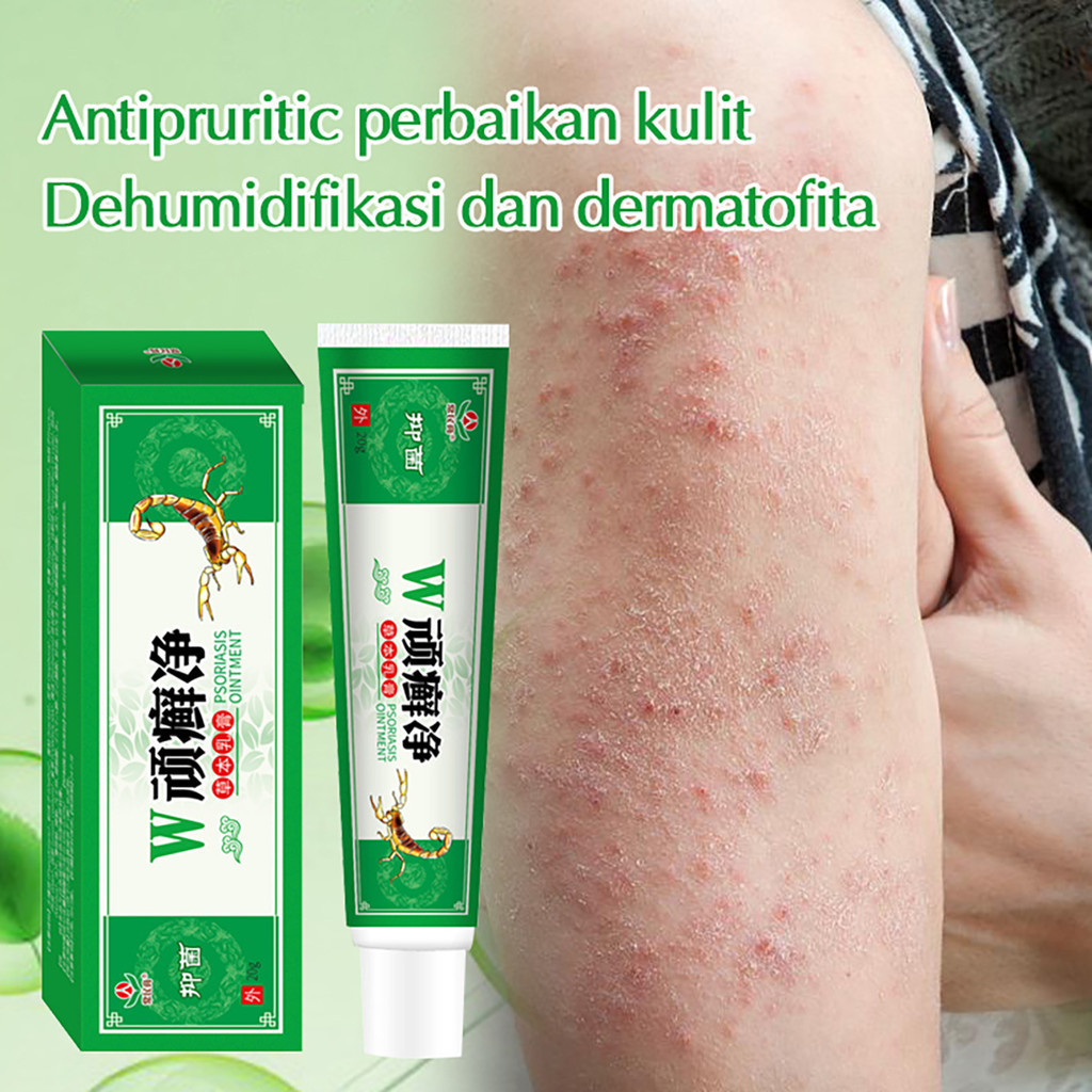 Jual COD Salep obat kulit gatal Gatal - Obat Gatal Selangkangan Eksim ...