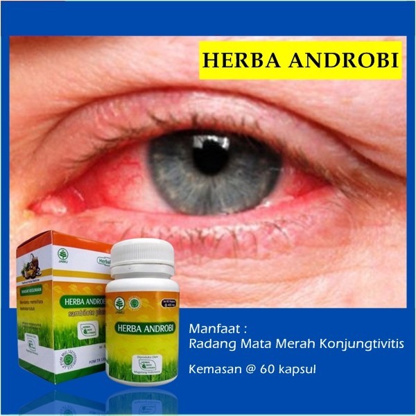 Jual Obat Mata Konjungtivitis Mata Merah Dan Gatal Bpom 60 Kapsul 