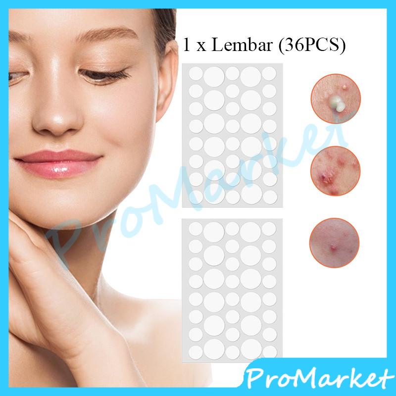 Jual Acne Pimple Patch Acne Treatment Sticker Jerawat Penghilang