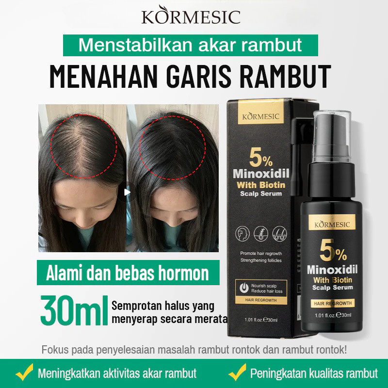 Jual Minoxidil penumbuh rambut serum penumbuh rambut obat rambut rontok ...