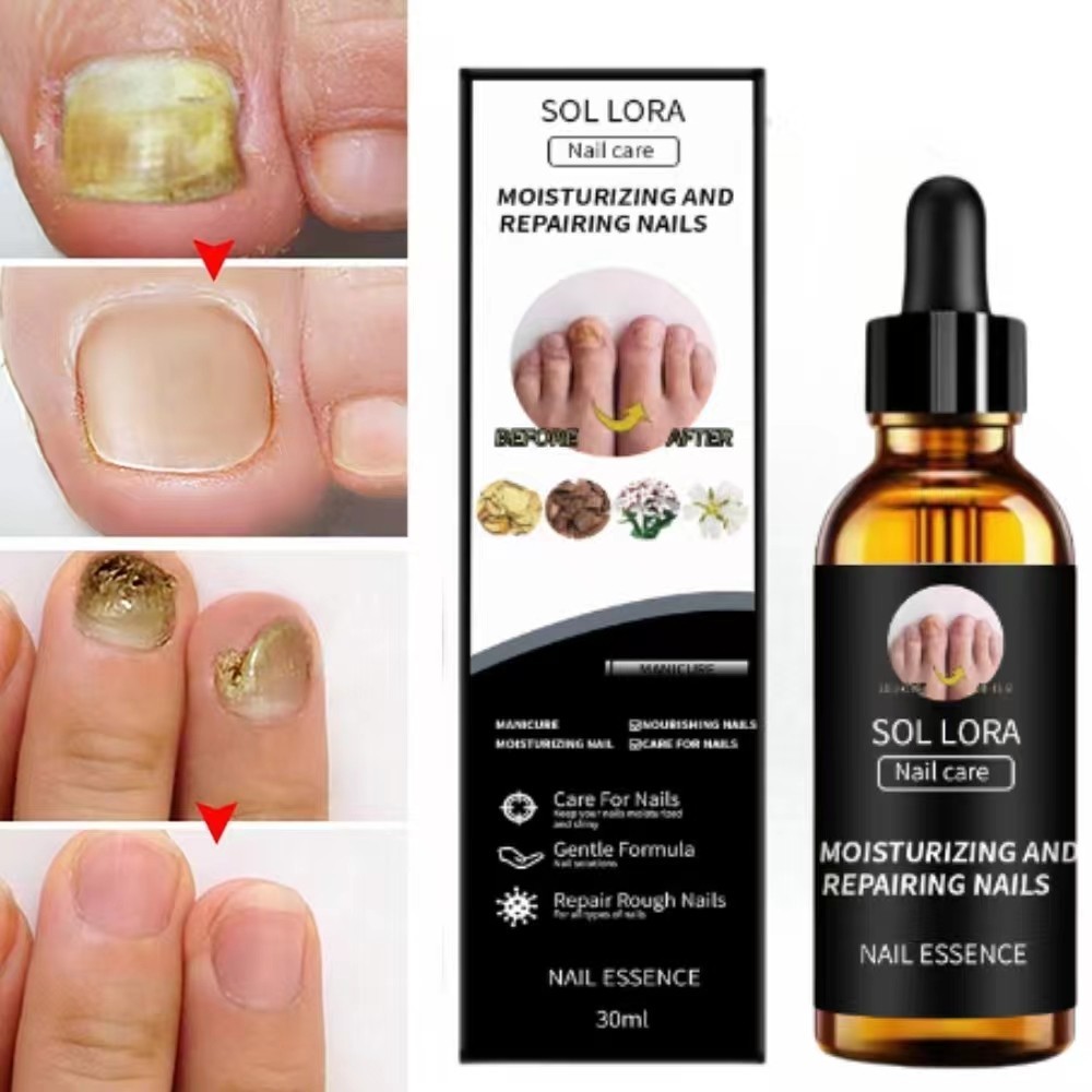 Jual Obat Jamur Kuku jamur dan rusak Nail Care Anti Jamur Perawatan ...