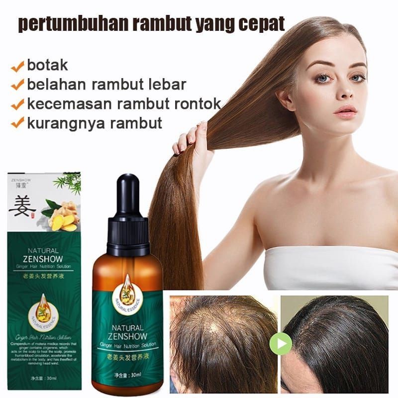 Jual Hanya 7 Hariserum Penumbuh Rambut Cepathair Oil Rambut Rontokhair Growth Serumobat 5823