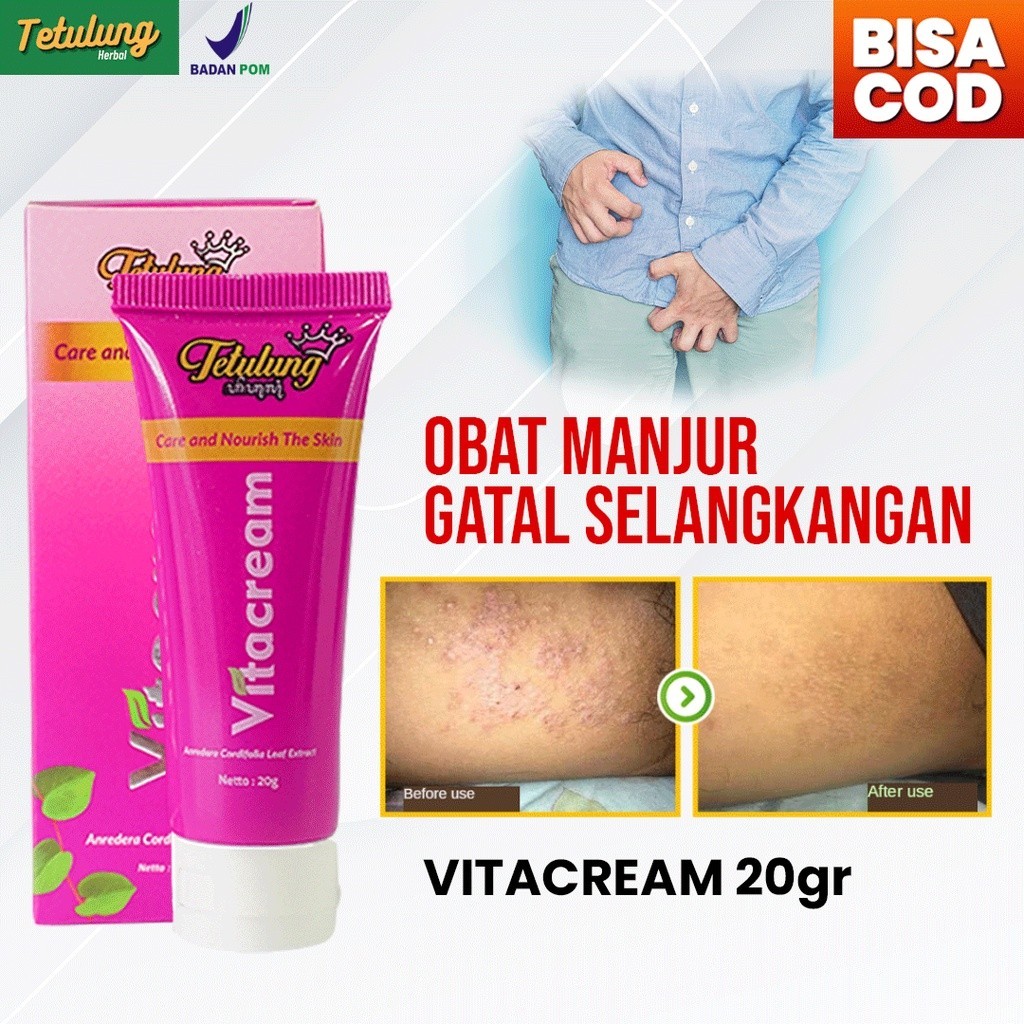 Jual VITACREAM - Obat Salep Untuk Gatal Selangkangan | Sudah BPOM ...