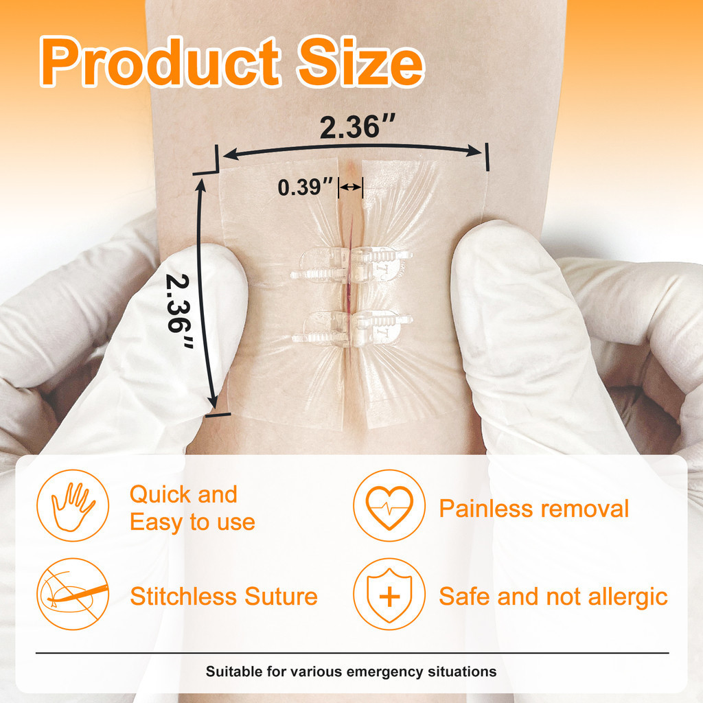 Jual CARBOU 2PCS Zipper Painless Wound Closure Device Suture-free Wound ...