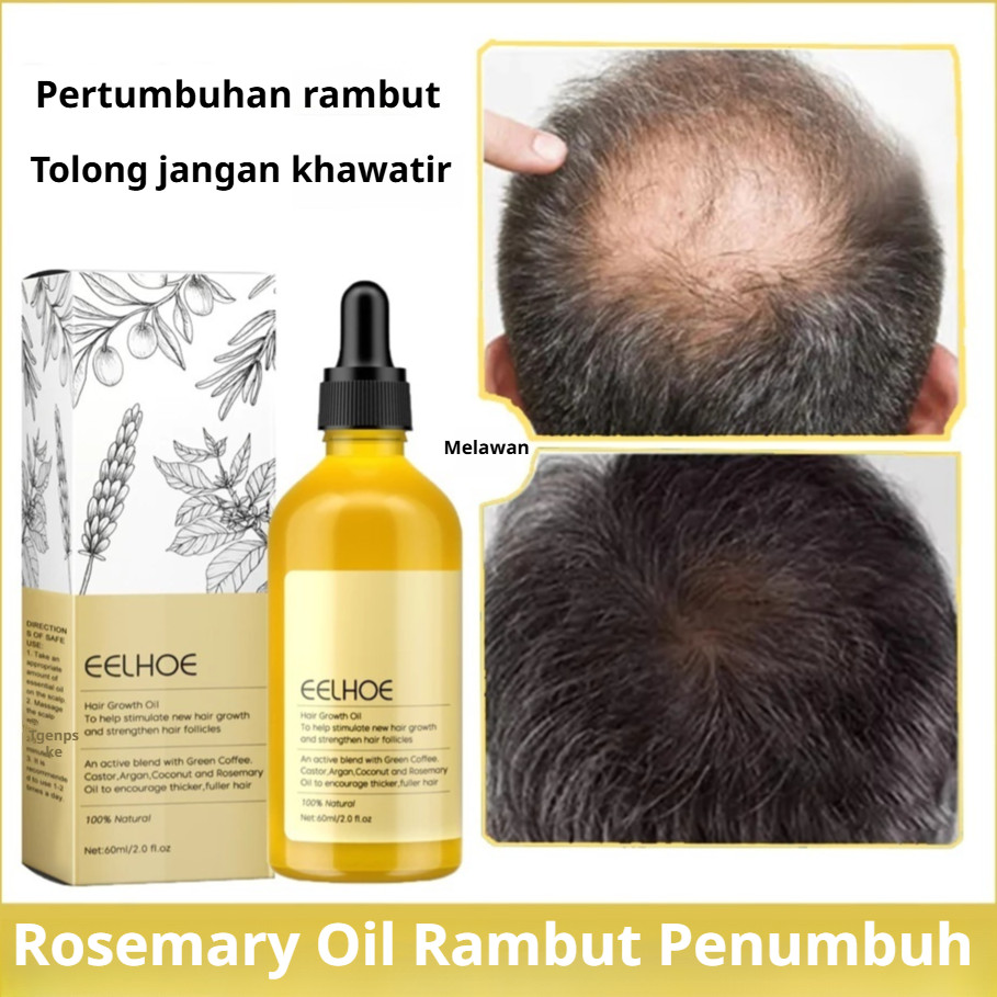 Jual 【Kirim dalam 24 jam】Rosemary Oil Penumbuh rambut cepat serum ...