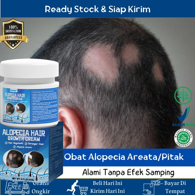 Jual [READY STOCK]Obat Alopecia Areata, penumbuh rambut cepat Obat ...