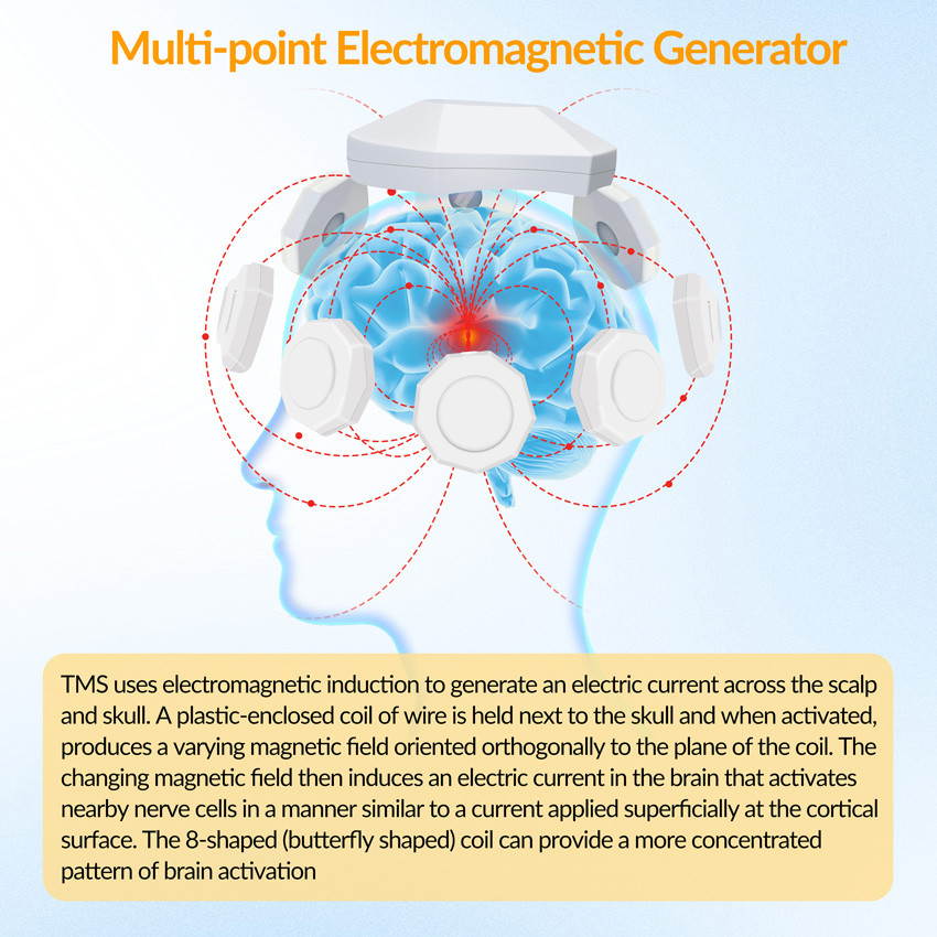 Jual TMS Transcranial Magnetic Stimulation Therapy for Depression and ...