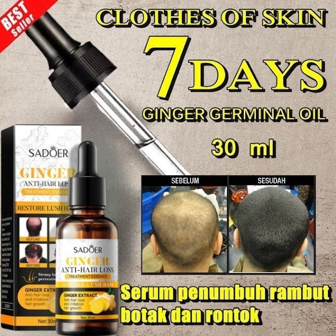 Jual Hair Treatment Hair Growth Moisturize Shampoo Ginger Herbal Essence 7days Clothes Of Skin 5029