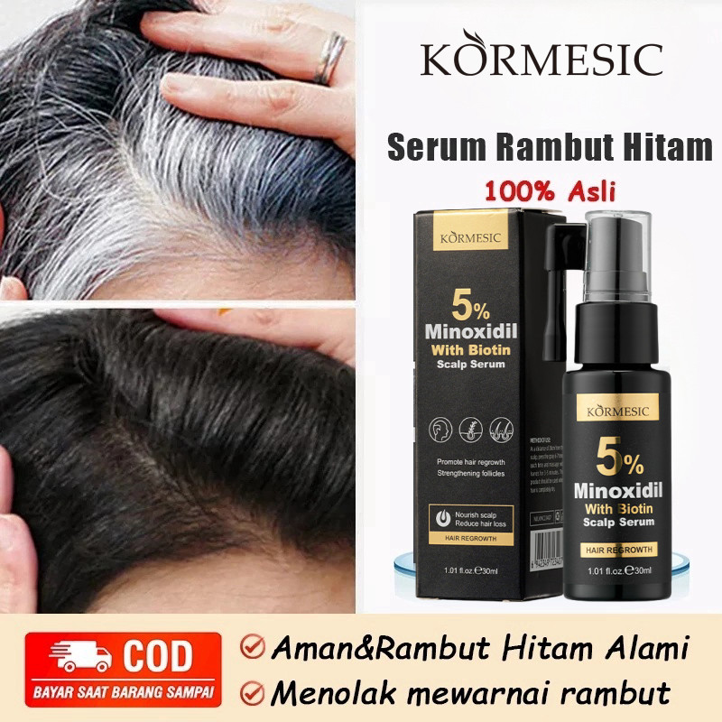 Jual Minoxidil penumbuh rambut serum penumbuh rambut obat rambut rontok ...