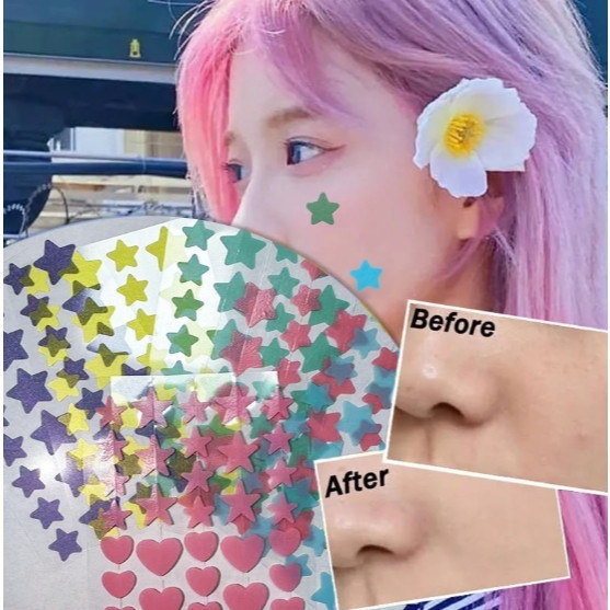 Jual GW ACNE PATCH STIKER PENGHILANG JERAWAT MOTIF LUCU / ACNE PIMPLE