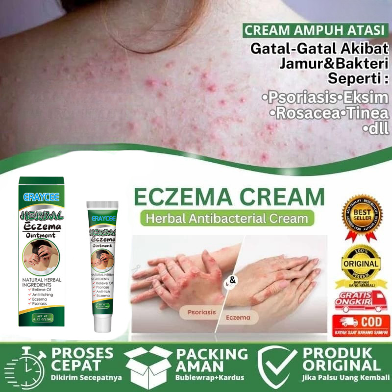 Jual Salep gatal Salep Eksim Salep kulit Krim psoriasis Eczema ...