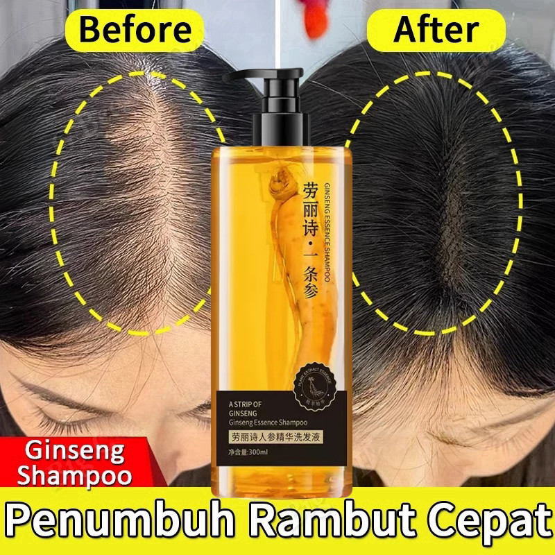 Jual shampoo penumbuh rambut cepat Ginseng Shampoo shampoo penumbuh ...