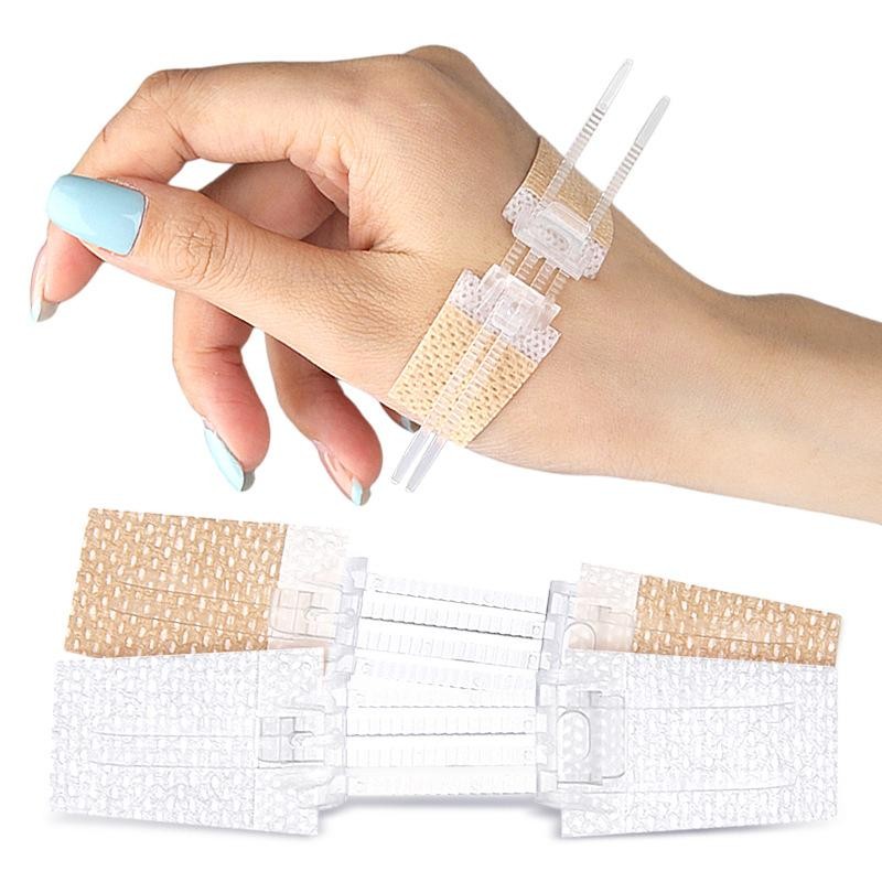 Jual Zipper Tie Wound Closure Patch Hemostatic Patch Wound Fast Without ...