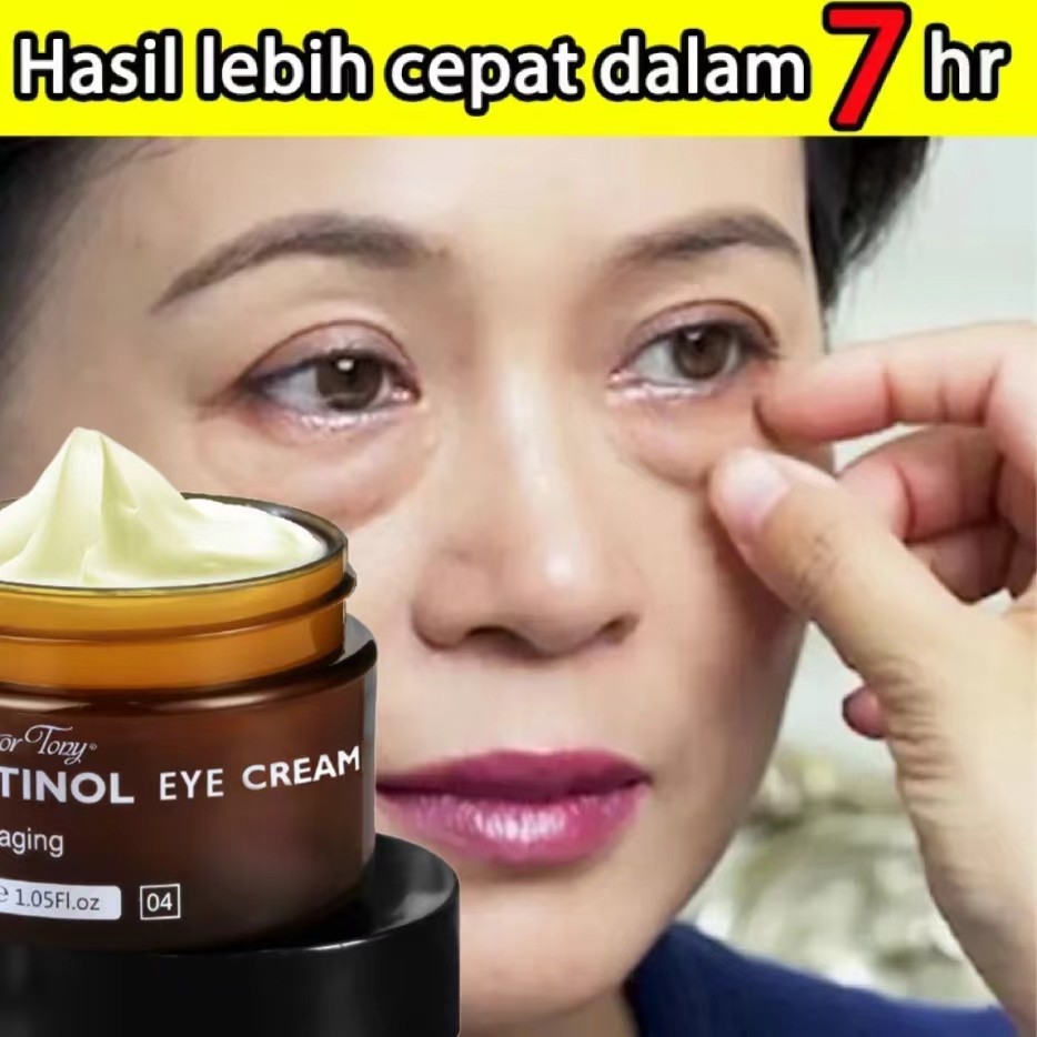 Jual eye cream/menghilangkan mata panda/penghilang kantung mata/eye