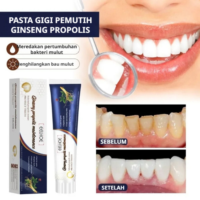 Jual Pasta Gigi Perawatan Gigi Goyang 100g/Gigi goyang 101% sembuh ...