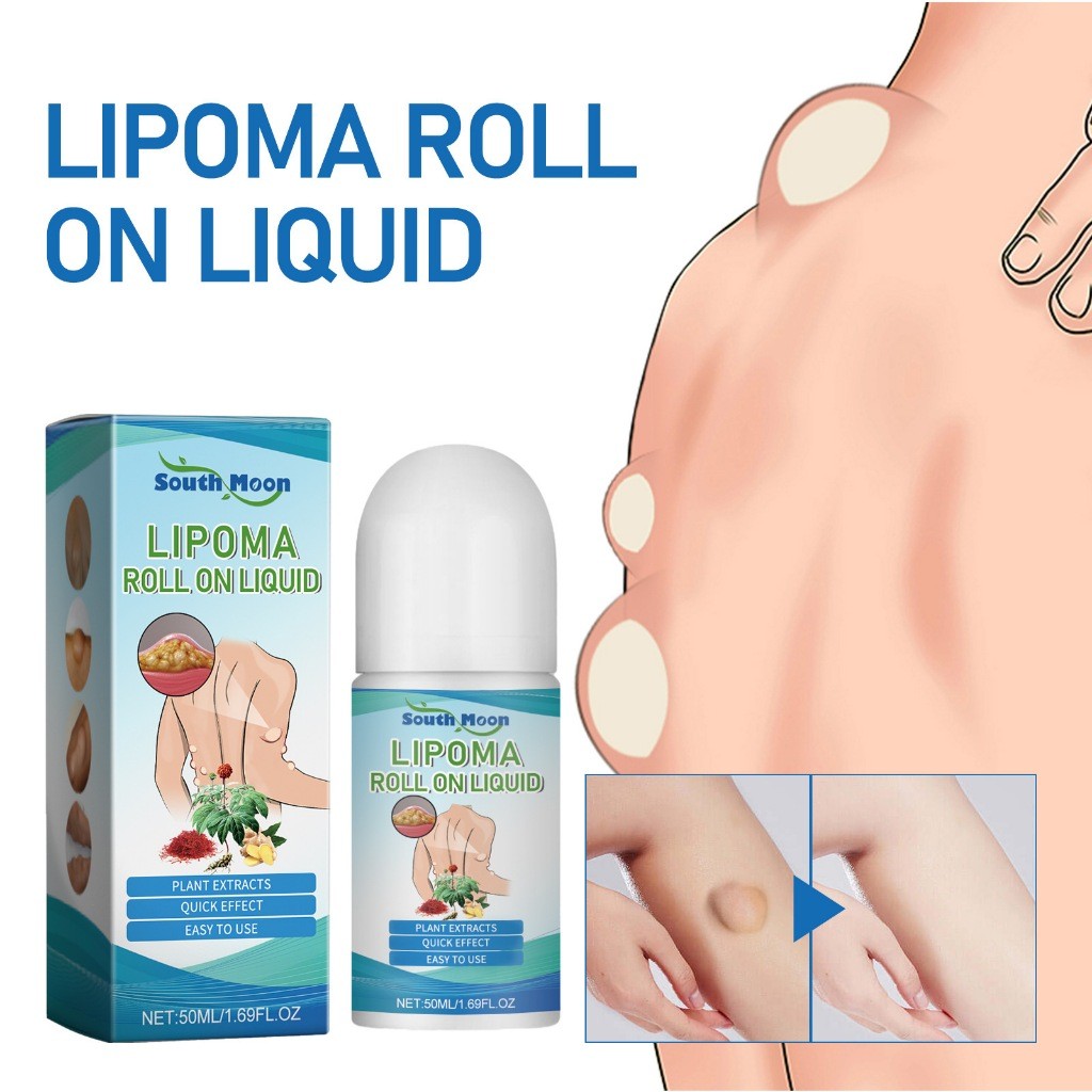 Jual South Moon Lipoma Removal Roller Relieve Plaster Lipolysis Fat ...