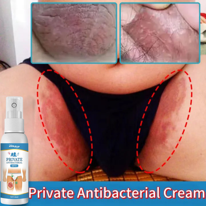 Jual Private Anti Bacterial spray Salep Gatal Selangkangan Eksim dan ...