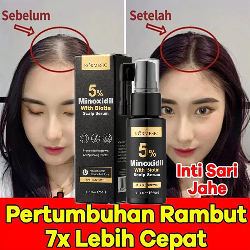 Jual Minoxidil Penumbuh Rambut serum Obat Penumbuh Rambut Botak Tipis ...