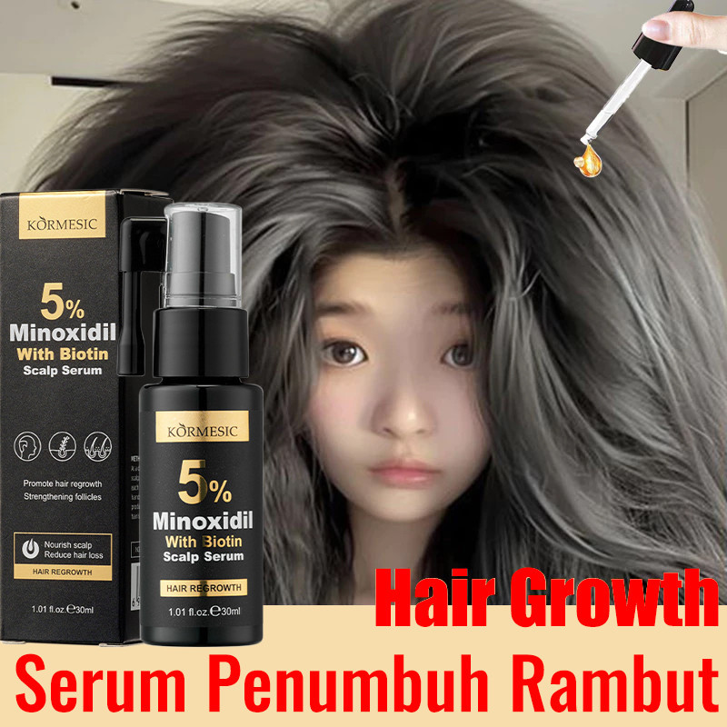 Jual Minoxidil 5% Penumbuh Rambut Obat Penumbuh Rambut Botak, Tipis Dan ...