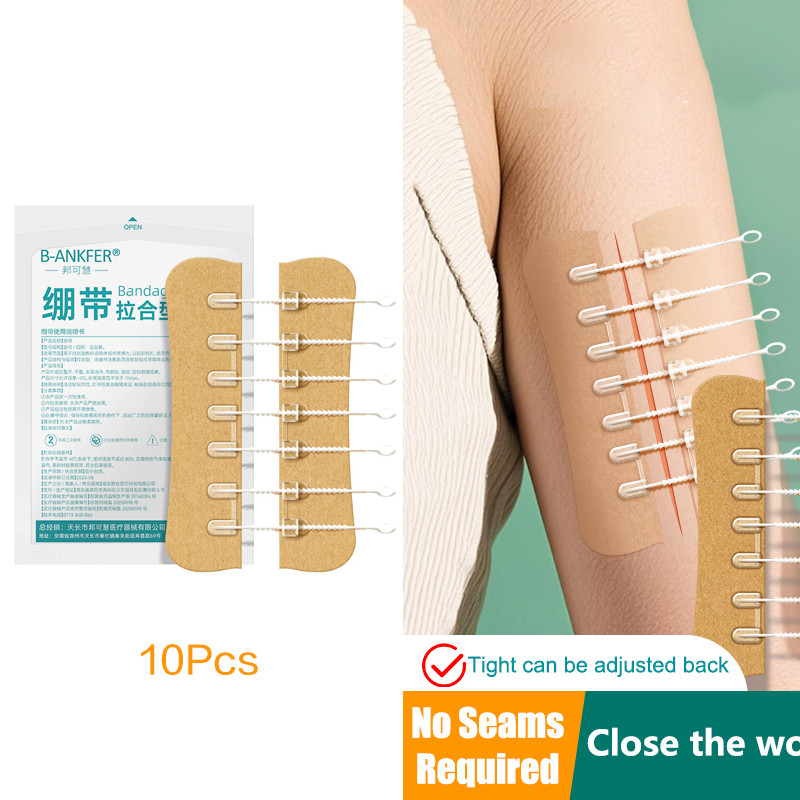 Jual Zipper Tie Wound Closure Patch Hemostatic Patch Wound Fast Without ...