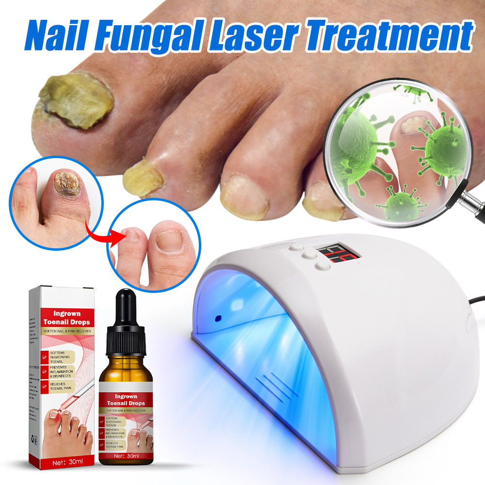 Jual Fungal Nail Laser Treatment Device Repair Toenail Anti Infection