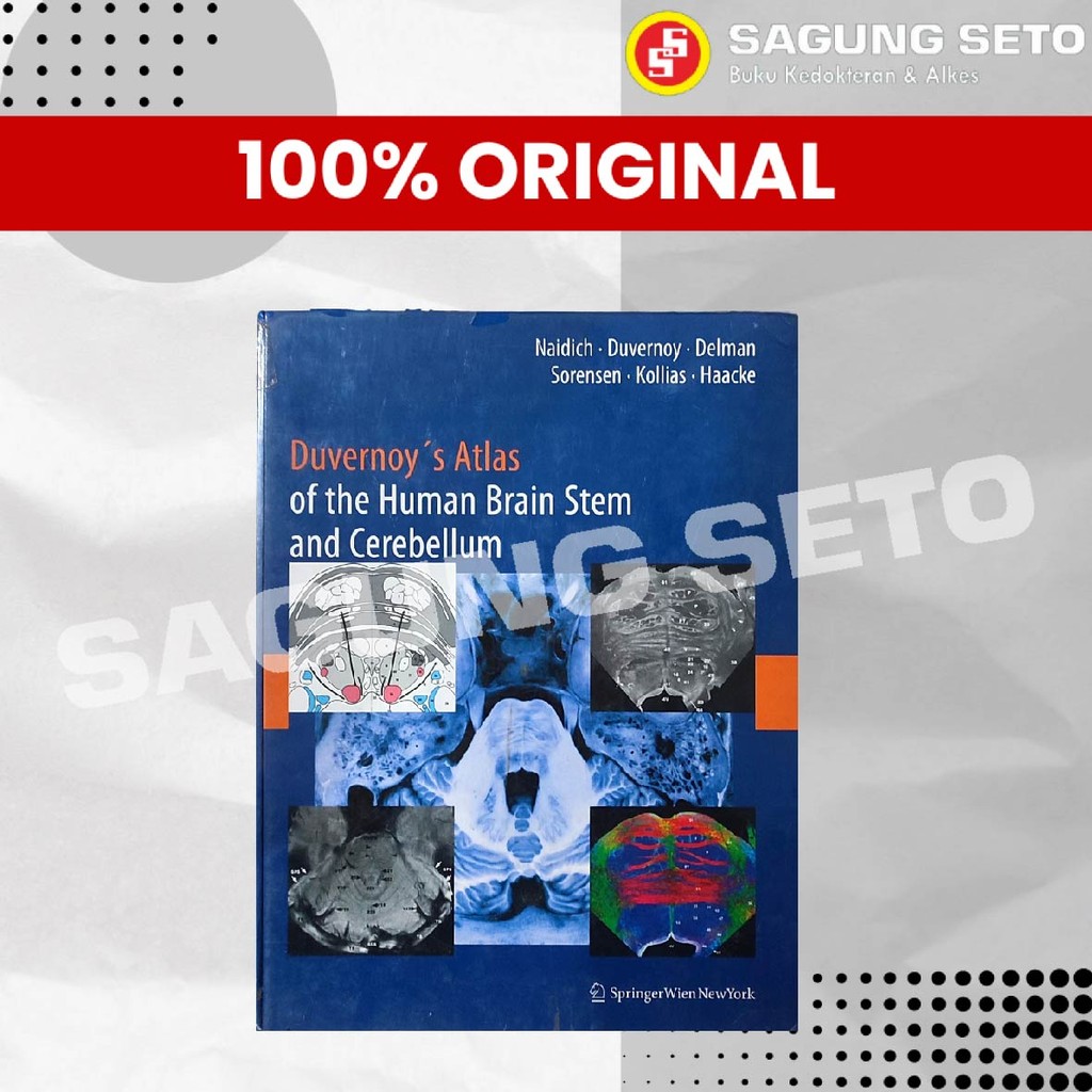 Jual DUVERNOYS ATLAS OF THE HUMAN BRAIN STEM AND CEREBLLUM - NAIDICH ...
