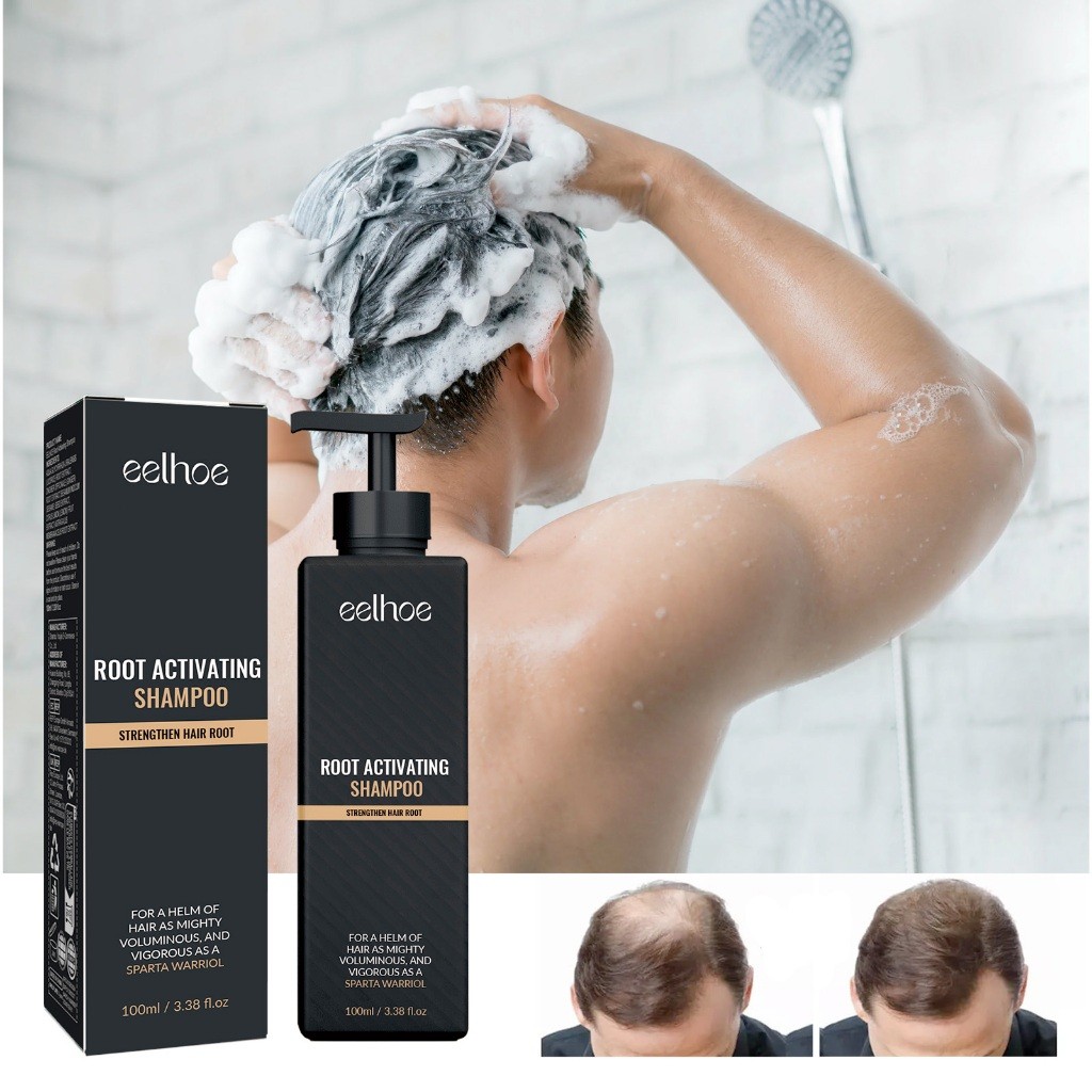 Jual EELHOE Root Activating Shampoo 100ml Penebalan Rambut Perawatan ...