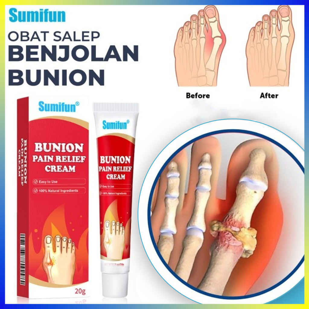 Jual SUMIFUN Cream Obat Salep Pereda Sakit Nyeri Sendi Otot Bunion ...