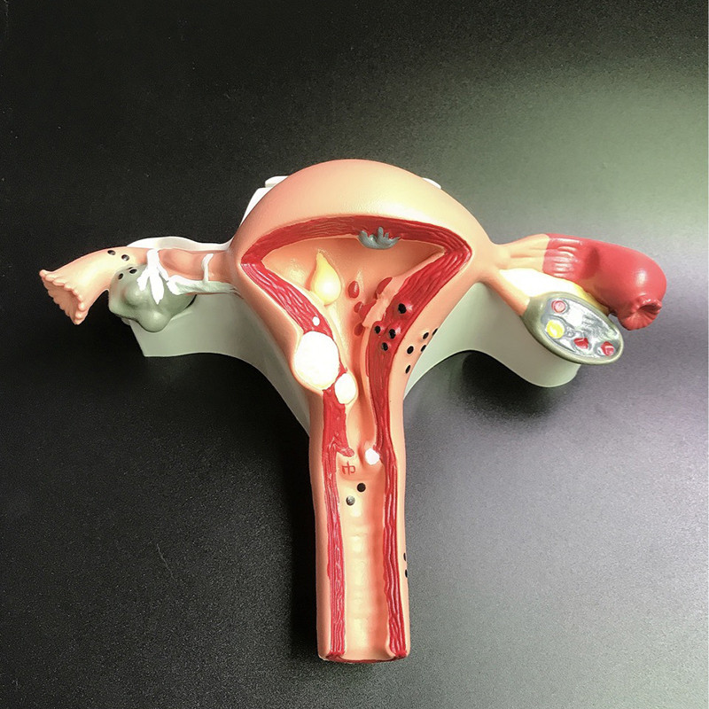Jual Human Uterus and Ovary Model, Female Reproductive Organ Model ...