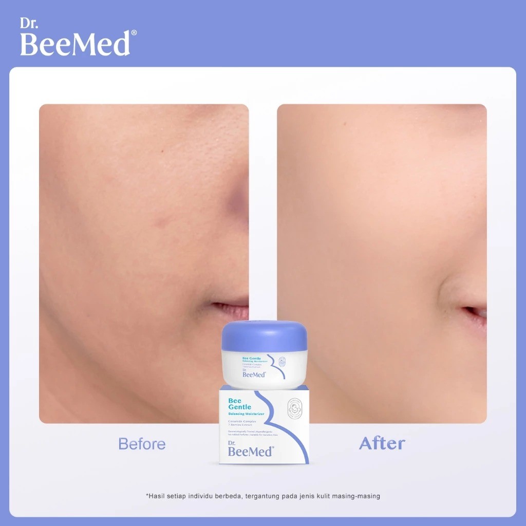 Jual Dr.BeeMed Membantu menyamarkan noda gelap Bee Gentle Balancing ...
