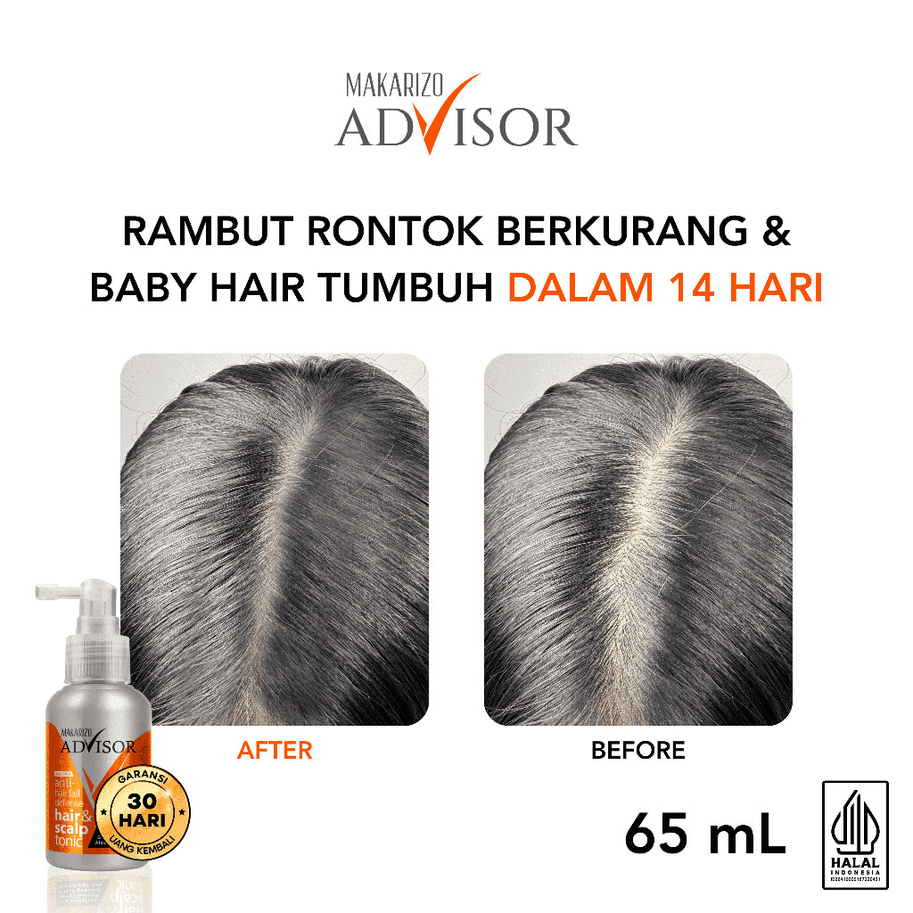 Jual Makarizo Advisor Hair & Scalp Tonic 65 mL - 2 in 1 Untuk Rambut ...