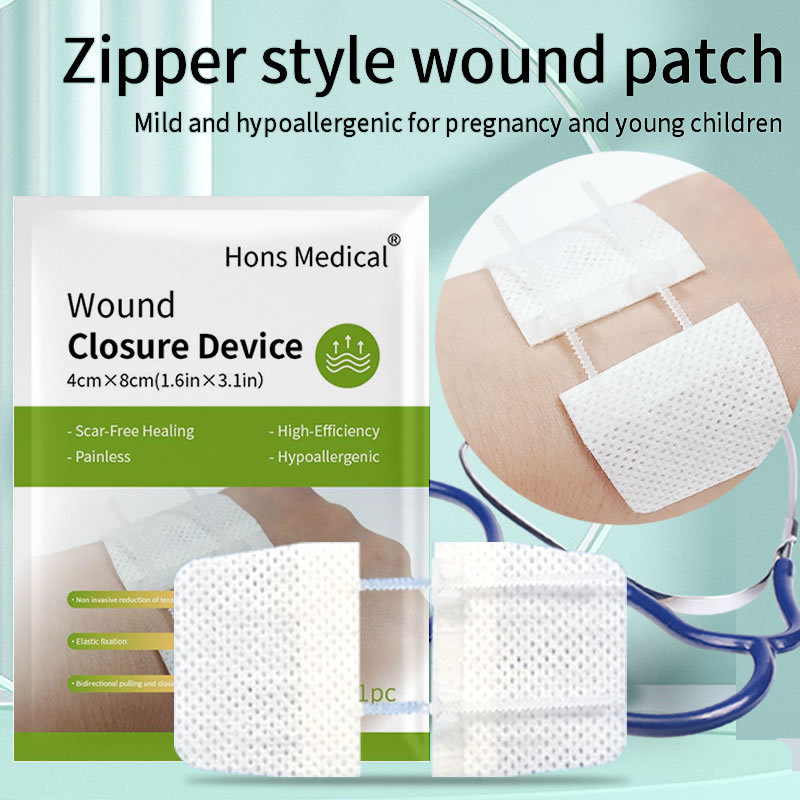 Jual Zipper painless wound closure device, no suture wound dressing ...