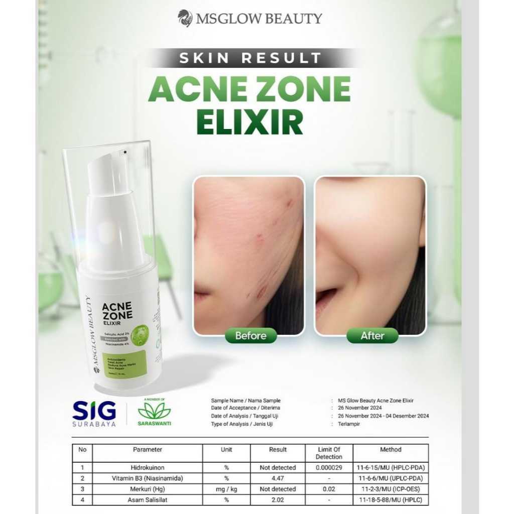 Jual MS GLOW - ACNE ZONE ELIXIR - 15 ML | Serum Acne Elixir Untuk atasi ...