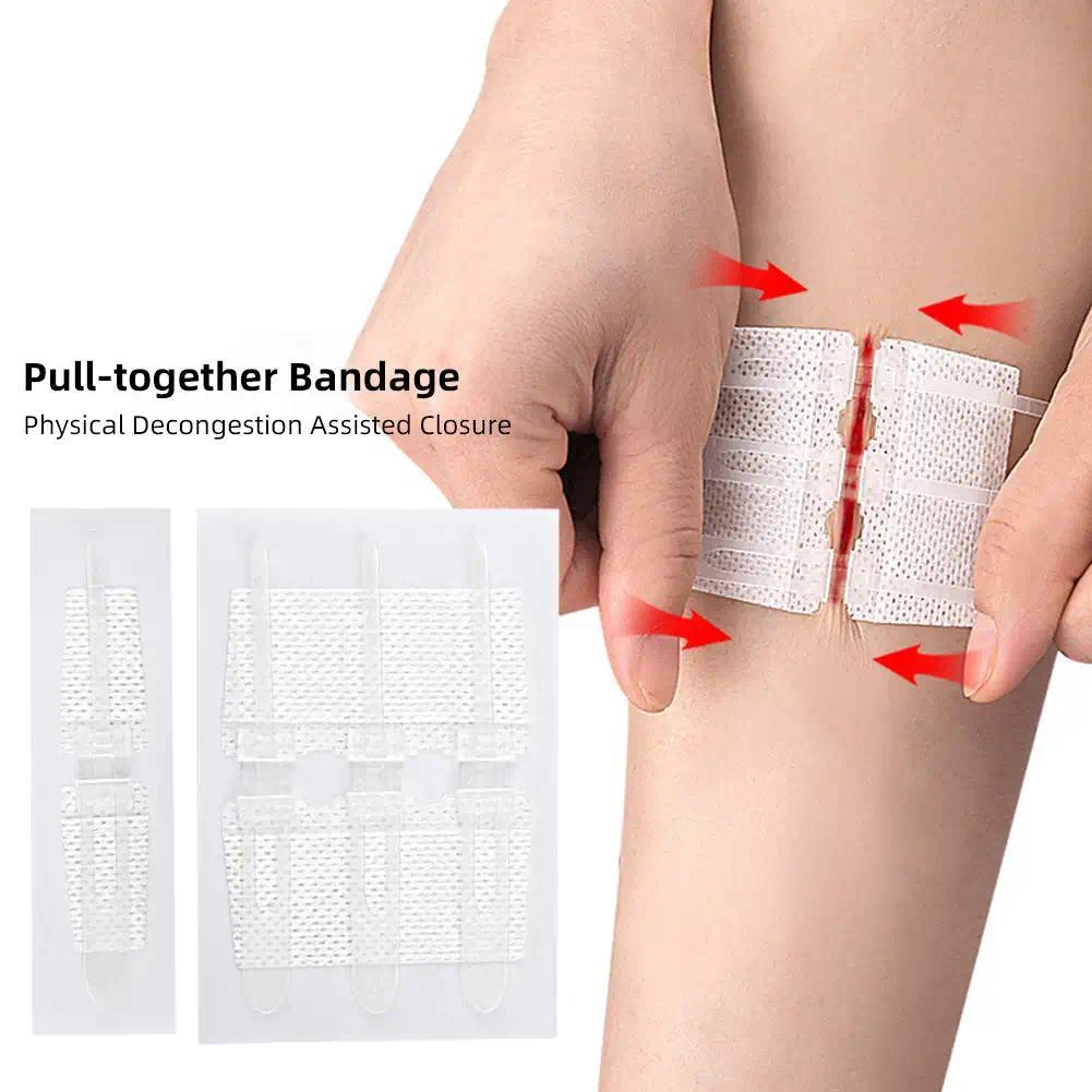 Jual Emergency Laceration Closures Band Zipper Painless Wound Closure ...