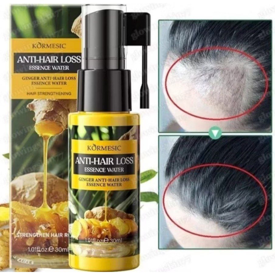 Jual Capillus Ginger essence / visible hair Growth approved serum BEST ...
