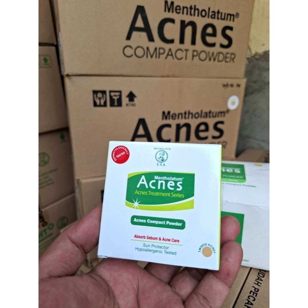 Jual Acnes Compact Powder 14gr (Chamaybeolshop) | Shopee Indonesia