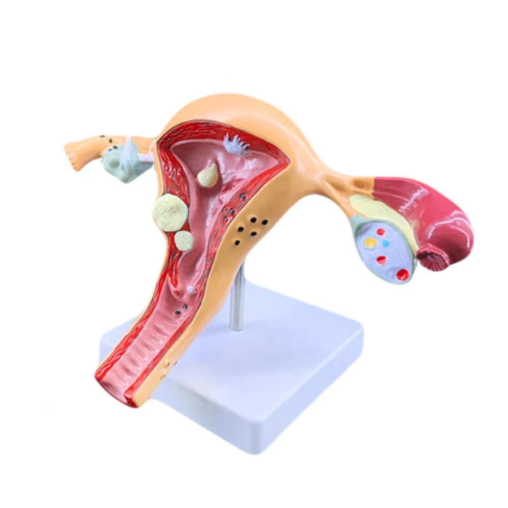 Jual Female Uterus Model Human Reproductive System Anatomy Ovarian ...